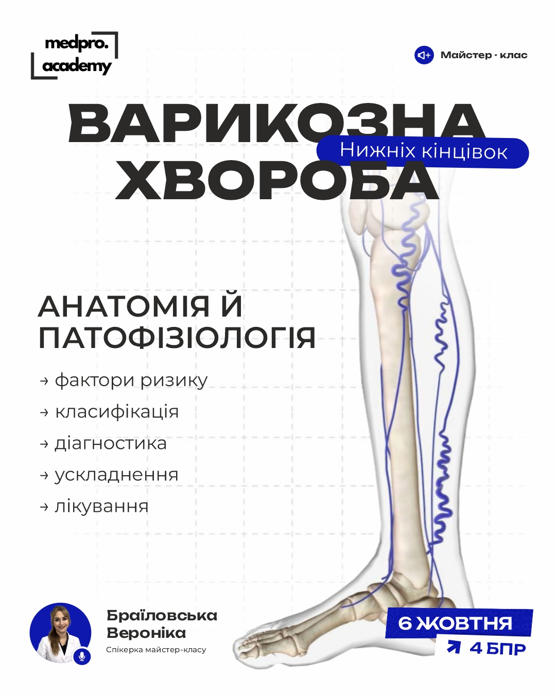 3Варикозна хвороба нижніх кінцівок
